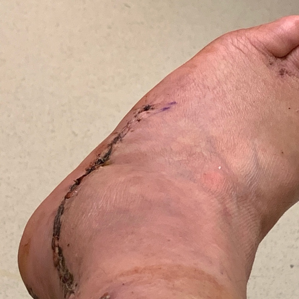 Meet your Posher, Mic